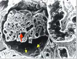 electron micrograph glomerulus scanning biology capsule bowman cells nephrons shows left